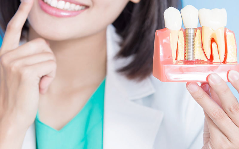 dentist showing restorative dental implant model