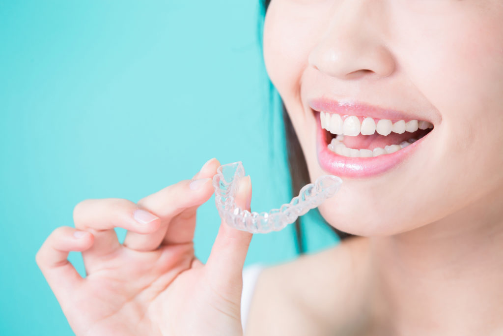 girl smiling and holding invisalign